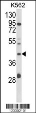 COQ3 Antibody