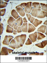 COQ3 Antibody