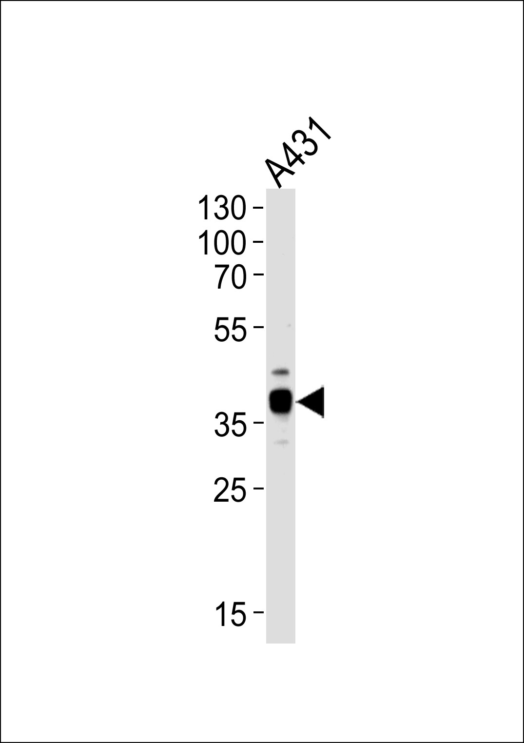 ARPC1B Antibody
