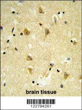 MPV17 Antibody