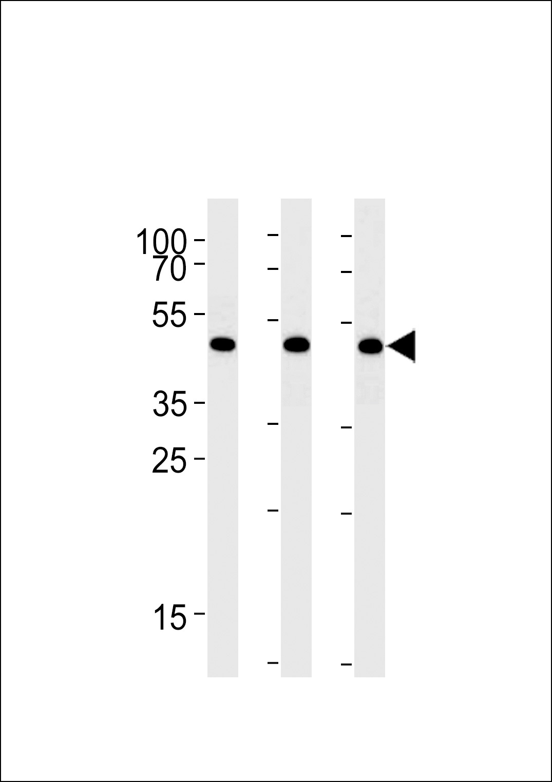 DDX39B Antibody