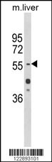 HNF1A Antibody