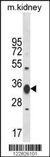 ACY3 Antibody