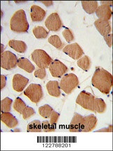 HACL1 Antibody