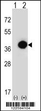 PHYH Antibody