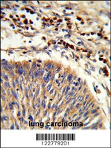 HSPA6 Antibody