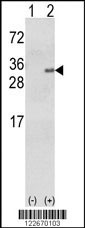 GSTA1 Antibody