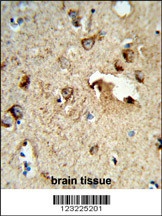 TSPAN1 Antibody