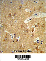 TSPAN12 Antibody