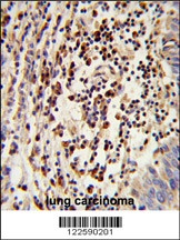 MARCH2 Antibody
