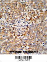 ALKBH3 Antibody