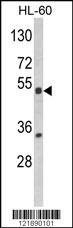 NR1I2 Antibody