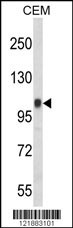 ITGB3 Antibody