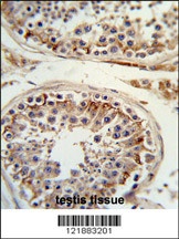 ITGB3 Antibody