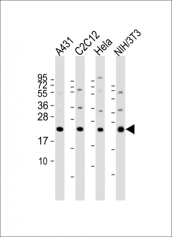 RAB7A Antibody