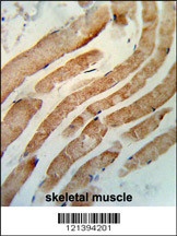 RAB7 Antibody
