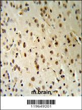 TARSL2 Antibody