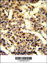 CYP2A13 Antibody