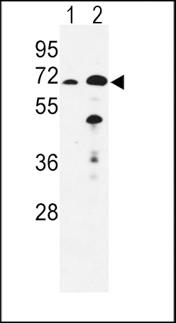 EHHADH Antibody