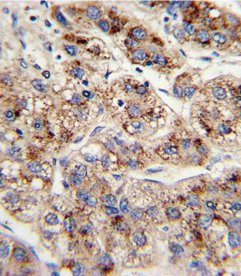 EHHADH Antibody