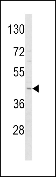 ADIPOR1 Antibody