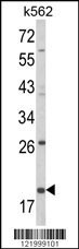 KLRD1 Antibody