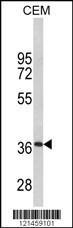 MPZ Antibody