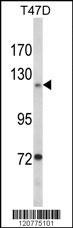 PTK2 Antibody
