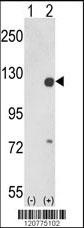 PTK2 Antibody