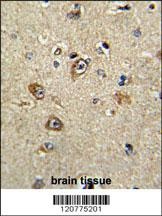 PTK2 Antibody