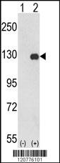 PTK2 Antibody