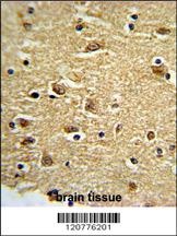 PTK2 Antibody