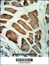 LMOD1 Antibody