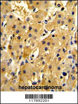 HPD Antibody