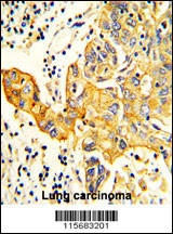 RARS2 Antibody