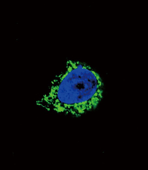 IGFBP2 Antibody