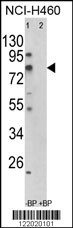 ACSS3 Antibody