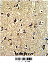 ABCC5 Antibody