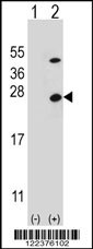 ATP5O Antibody