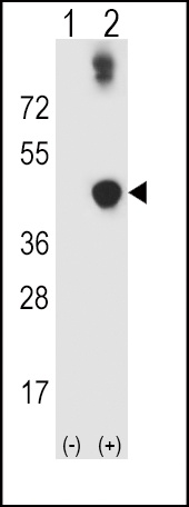 ADH5 Antibody