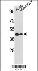 GSDMB Antibody