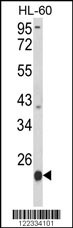 PSMB9 Antibody