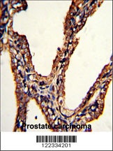 PSMB9 Antibody