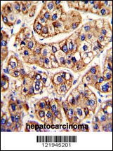 IFNAR1 Antibody