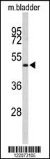 ACTR3B Antibody