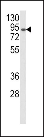AOC3 Antibody