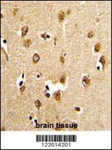 ABI1 Antibody