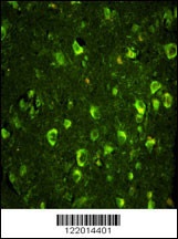 ABI1 Antibody