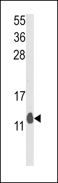 PEA-15 Antibody