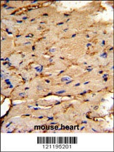 PEA-15 Antibody